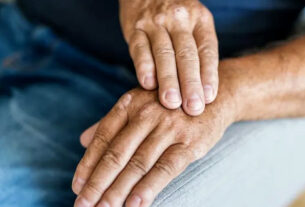 Arthritis how to get relief from it