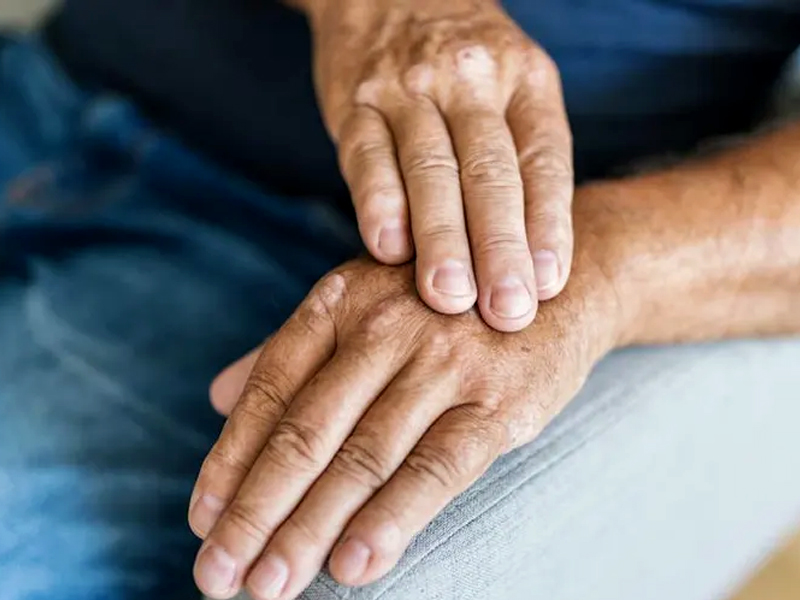 Arthritis how to get relief from it